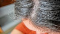 ما هي أسباب ظهور الشعر الأبيض وكيف تتخلص منه؟