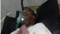 بوعزيزي الصعيد.. قصة شاب مصري أشعل النار بجسده بسبب "موظفين لا يشبعون"