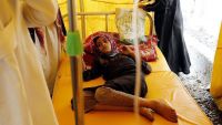 الصليب الأحمر: ارتفاع وفيات الكوليرا في اليمن إلى 1587