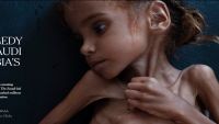 "فيسبوك" يكسر قواعده لأجل طفلة يمنية تتضور جوعا