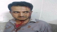 ردود منددة بعد اعتداء مشرف حوثي على طبيب في مستشفى الثورة بصنعاء