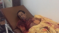 الضالع.. مقتل طفل برصاص قناص حوثي في قعطبة