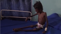الفاينانشال تايمز: إدارة ترامب تدفع اليمن إلى المجاعة
