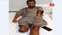 أسر قتلى وجرحى المقاتلين مع السعودية يعانون الألم والخذلان (تحقيق)