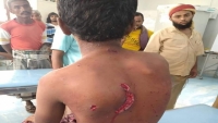 مقتل وإصابة ثلاثة صيادين يمنيين بنيران قوات إريترية قبالة جزيرة حنيش