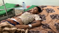 أطباء بلا حدود: عالجنا 241 شخصا أصيبوا بلدغات الأفاعي في اليمن