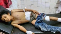 إصابة طفل جراء قصف حوثي استهدف حي سكني شرقي تعز