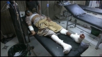 مقتل وإصابة مدنيين بانفجار لغم زعه الحوثيون جنوبي الحديدة