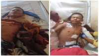 إصابة أربعة أطفال وامرأة بقصف للحوثيين غربي تعز