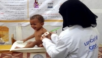 الموت جوعا يهدد الطفلة رندا وملايين اليمنيين بسبب نقص المساعدات