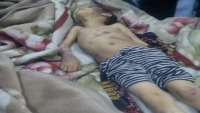 مقتل طفلة بعد تعرضها للتعذيب من قبل أبيها بمحافظة إب