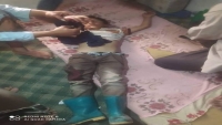 إصابة طفل جراء قصف حوثي جنوبي تعز