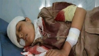 منظمة حقوقية: مقتل وإصابة أكثر من 14 ألف طفل خلال سنوات الحرب في اليمن