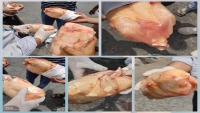 "هيئة المواصفات" تعلن ضبط شحنة دجاج فاسدة في عدن