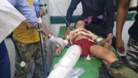 إصابة 12 طفلا جراء قصف حوثي استهدف حي "الروضة" بمدينة تعز