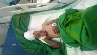 إصابة طفل برصاص قناص حوثي شرقي مدينة تعز