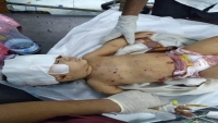 مؤسسة حقوقية تُوثق مقتل وإصابة 18 مدنيا في عتق خلال المواجهات المسلحة