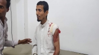إصابة شاب برصاص قناص حوثي في مدينة تعز