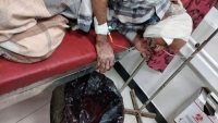 إصابة مواطن برصاص قناص حوثي في تعز