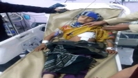 إب.. إصابة طفلة نتيجة العبث بالسلاح في ريف المحافظة