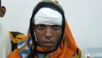 إصابة امرأة وطفلة برصاص قناص حوثي شمالي تعز