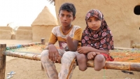الأمم المتحدة: سقوط 17 ضحية في الحديدة جراء الألغام الحوثية خلال مارس الماضي
