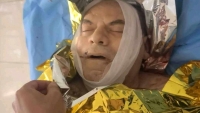 الغذاء العالمي يؤكد مقتل مدير مكتبه في تعز ويعتبر الحادثة "مأساة عميقة"