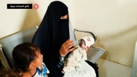 "الهزال" يلاحق 100 ألف طفل يمني تحت الحصار الحوثي
