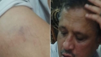 نقابة الصحفيين تدين الإعتداء على الصحفي مجلي الصمدي واستمرار ترهيبه