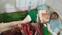مقتل طفل وإصابة شقيقه بقصف حوثي شمالي تعز