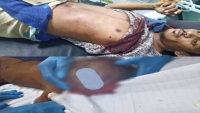 مقتل طفل وإصابة والده بقصف حوثي شمالي الضالع